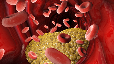 Want to Improve Your Cholesterol Profile?